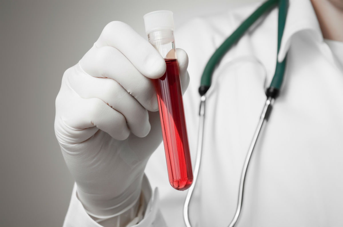 Blood-test-tube-photo